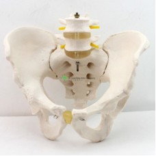 Model Pelvis with 4th and 5th Lumbar Vertebrae